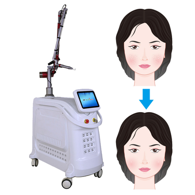 Pico-Lasermaschine 532nm 1064nm 755nm Q-Schalter und YAG-Lasergeräte