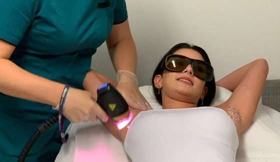 808nm Dioden Laser Haarentfernung Maschine TUV ISO CE Zertifizierung zum Entfernen von Poren