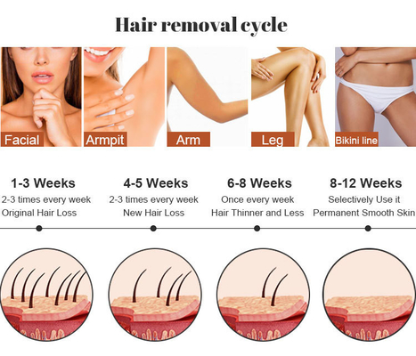 Schönheitssalon IPL Lasermaschine Haarentfernung RF Hautpflege Tätowierung Entfernung