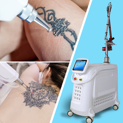 OEM ODM Maßgeschneiderte Picosecond Laser Tattoo Entfernung Maschine mit 15 Zoll Farb-Touchscreen