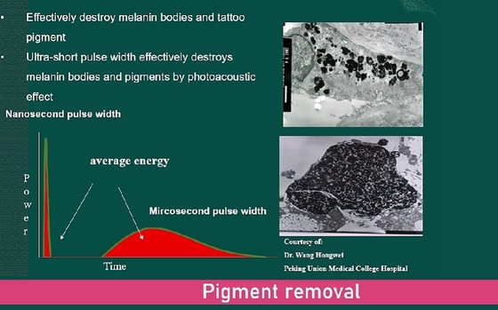 Kommerzielle Picosecond YAG Laser Maschine 3500W Schmerzlose Laser Tattoo Entfernung Gerät