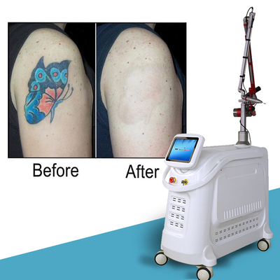 Feststehende Picosecond Lasermaschine 2000W Q Switched Nd YAG Laser Tattoo Entfernung Maschine