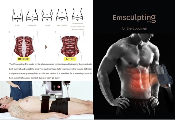 Fortgeschrittene EMS-Schlankheitsmaschine 150 Hz Frequenz zur Cellulite-Reduktion