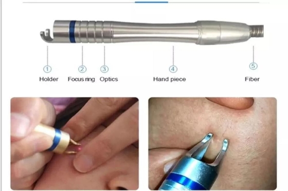 15W 30W Laser Gefäßentfernung Maschine für die Behandlung von Zehennägeln / Hot Laser Hautverjüngung