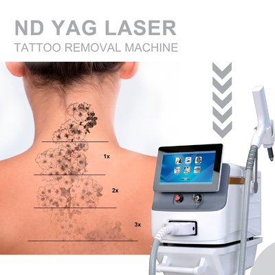 Langpulse Nd YAG Laser-Haarentfernung Maschine