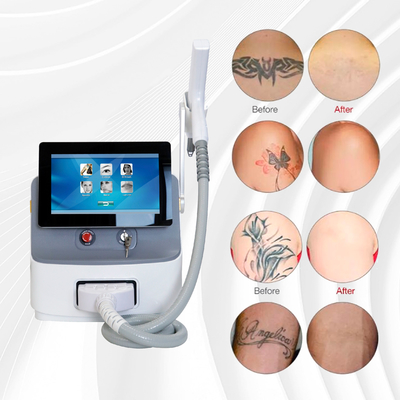 Langpulse Nd YAG Laser-Haarentfernung Maschine