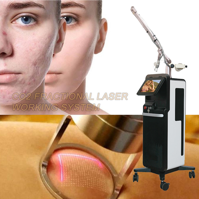 Professionelle Fractional Laser CO2-Maschine zur Hautwiederherstellung / -verstärkung