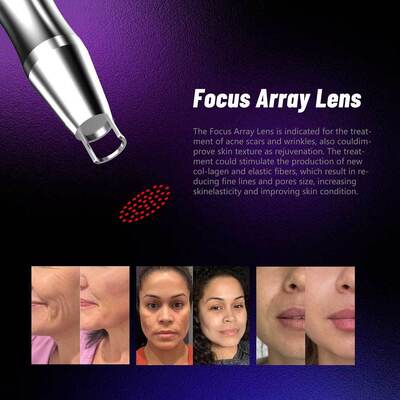 3000W 350PS Picosecond Pico Way Laser Pigment Entfernung Nd Yag Laser Picosecond Tatoo Entfernung Laser Maschine EU Stecker