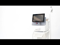 Wie wählt man eine Haarentfernungsanlage aus?